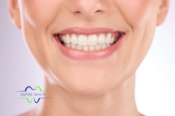 Follow your teeth whitening aftercare Crawley to prolong your whiter smile!